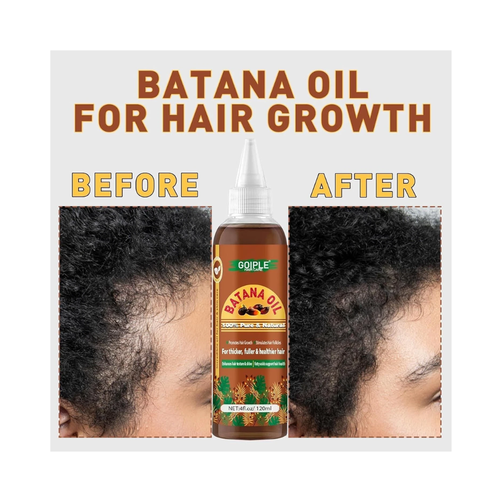 GOIPLE Batana Oil for Hair Growth Organic Hair Growth Oil 100% Pure Hair Oil Natural 4 oz - BRAID BEAUTY