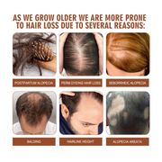 eelhoe 100% UNREFINED BATANA OIL REVITALIZED HAIR GROWTH & STRENGHT - BRAID BEAUTY